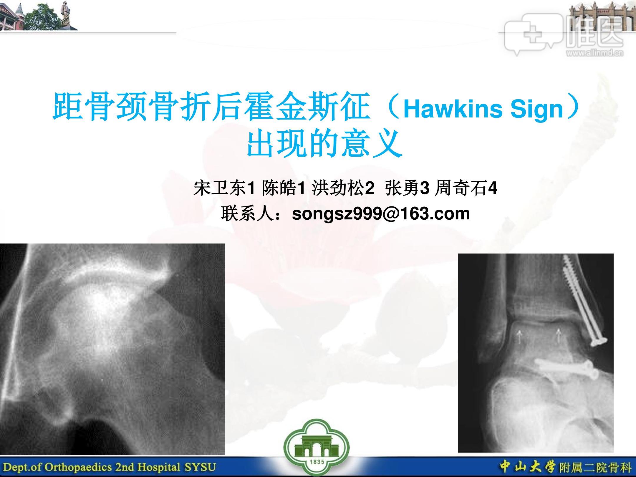 距骨颈骨折后霍金斯征(hawkins sign)出现的意义