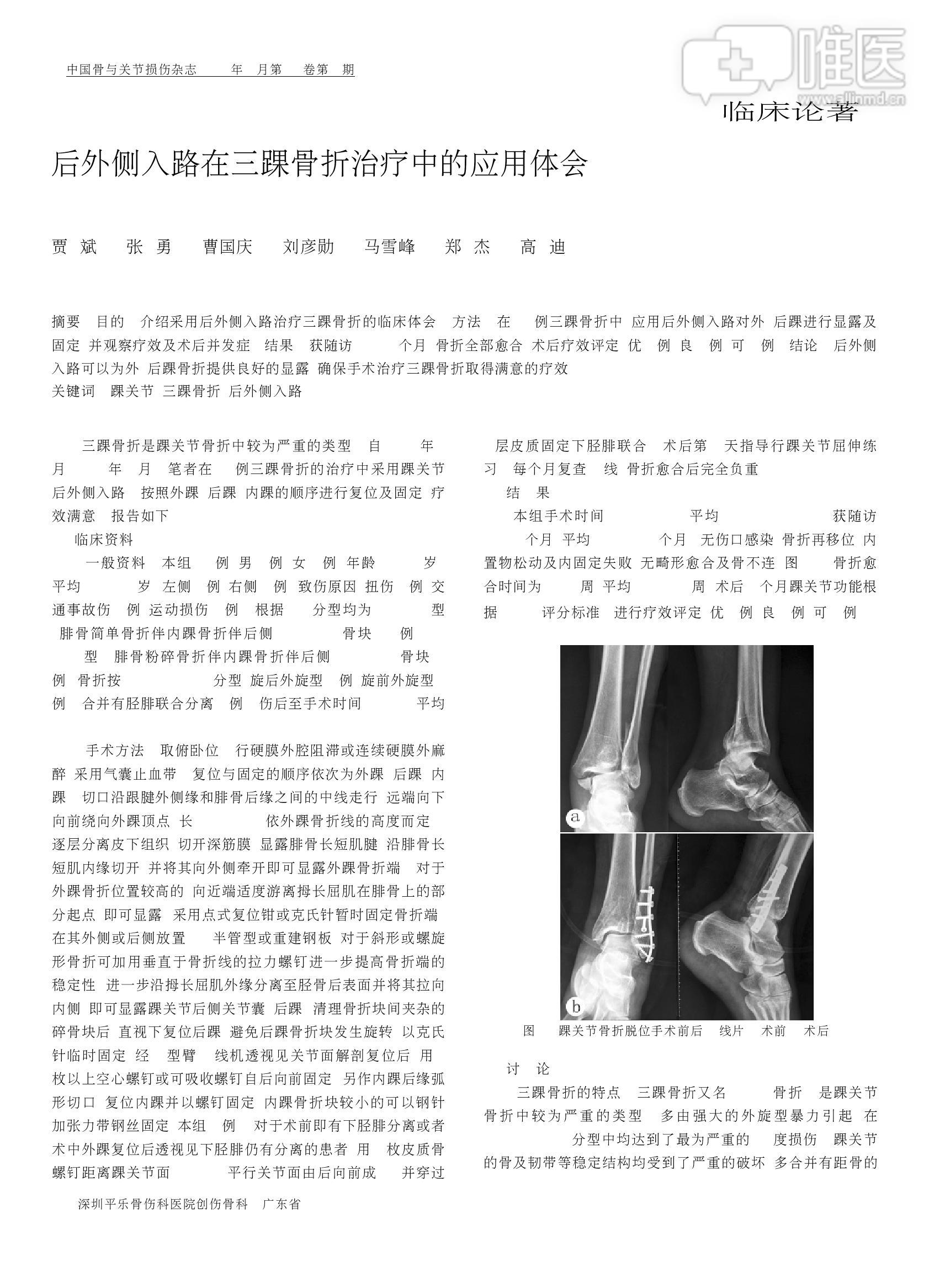 后外侧入路在三踝骨折治疗中的应用体会