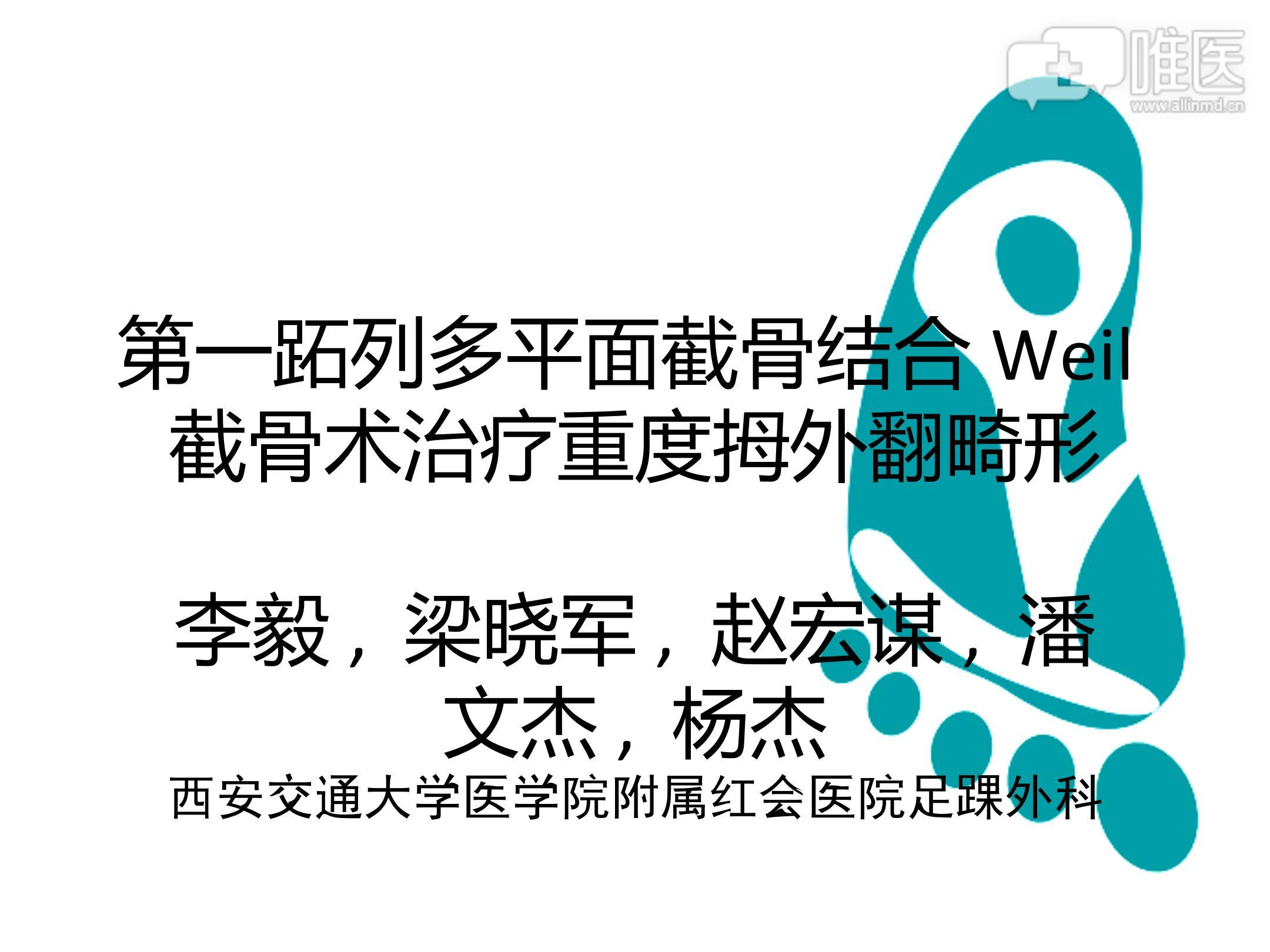 第一跖列多平面截骨结合weil截骨术治疗重度拇外翻畸形