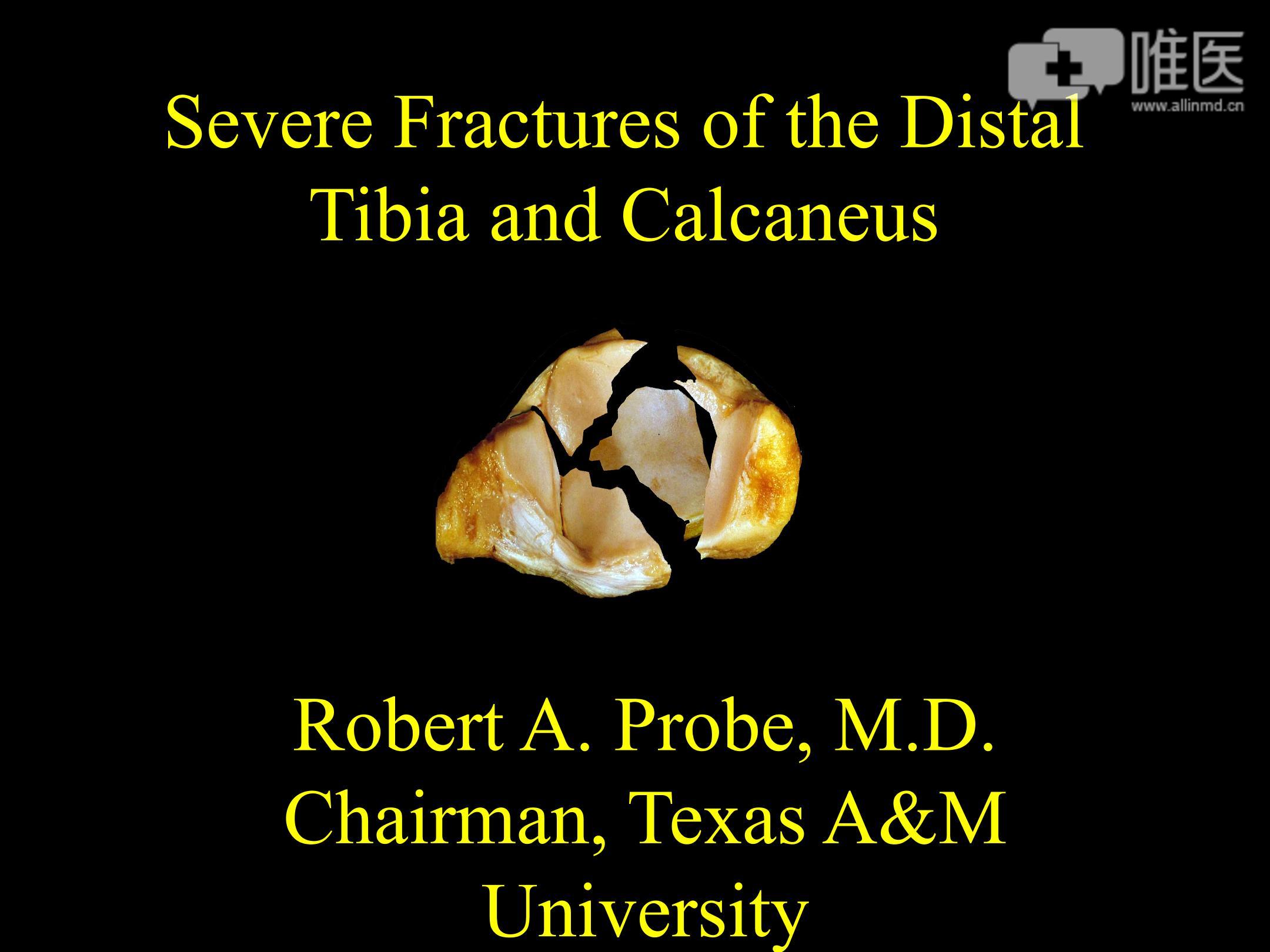severefracturesofthedistaltibiaandcalcaneus